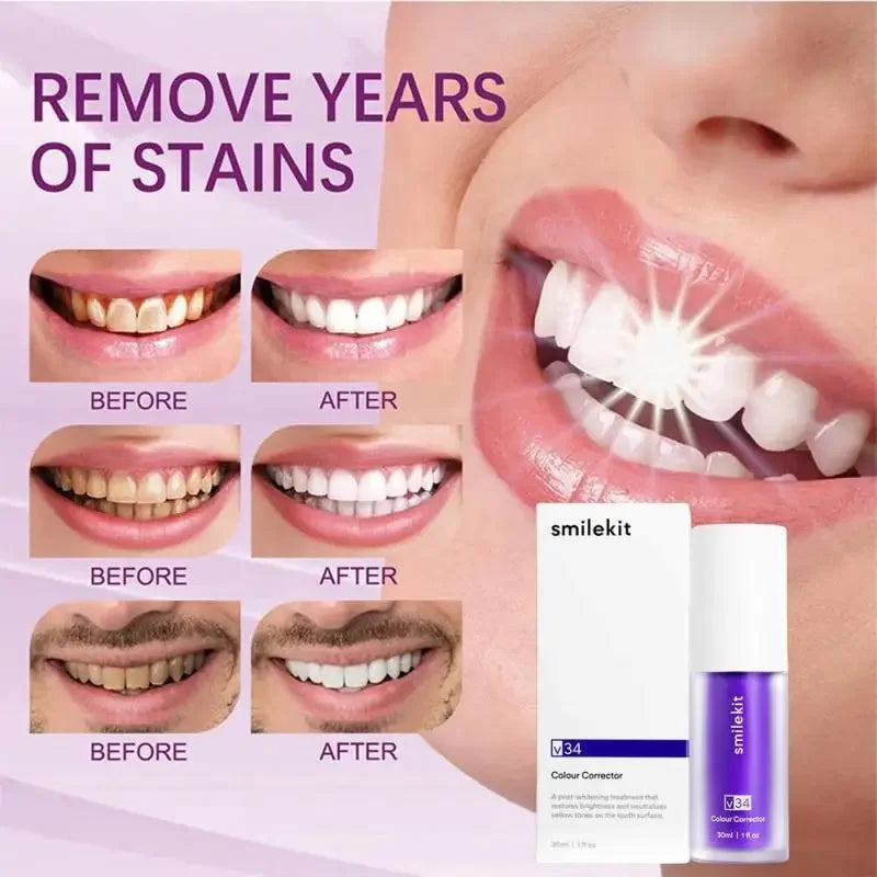 V SmileKit Purple Toothpaste Top Skin-Beauty Store